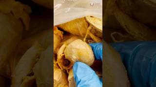 HUGE Ovary!
