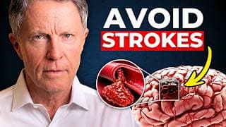 The EXACT Formula to Avoid a Stroke (Doctors Won't Tell You)