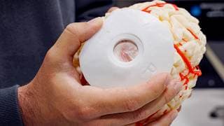 Our First Transdural Procedure | Neuralink