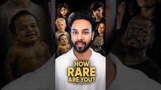 What Rare Body Feature Do You Have