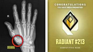 Broken Thumb to RADIANT??